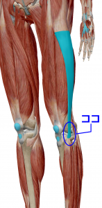 ランナーズニー　膝の外側の痛み