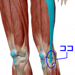 ランナーズニー　膝の外側の痛み